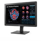 LG 24HR513C 24" 2MP IPS CLINICAL REVIEW MONITOR