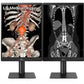 LG 21.3'' 3MP IPS DIAGNOSTIC MONITOR